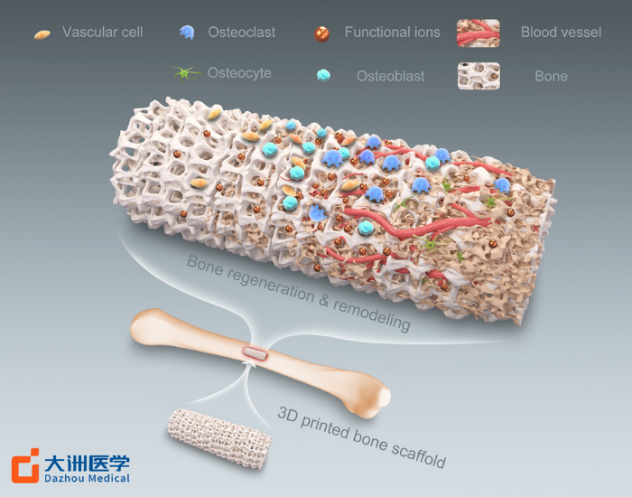 產(chǎn)品&解決方案-詳細大圖-人工骨.png